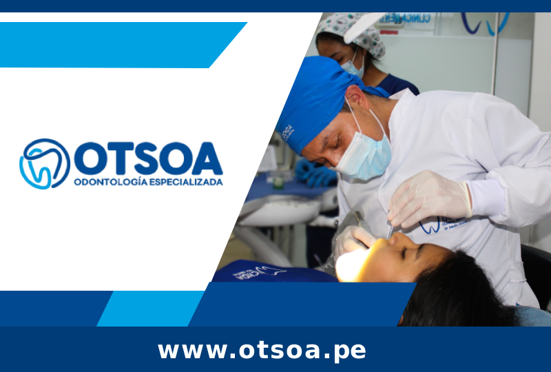 imgi_23_otsoa-pe